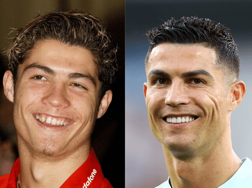 Championship Smile Transformations