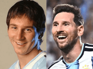 Lionel Messi cosmetic dentistry procedure smile transformation